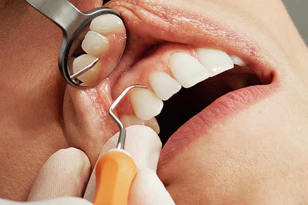 hawthorn periodonticsn